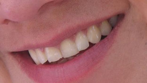 Des scientifiques japonais ont trouvé un moyen de vous donner un sourire éclatant