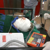 Archive: une femme qui s'était immolée par le feu en 2005